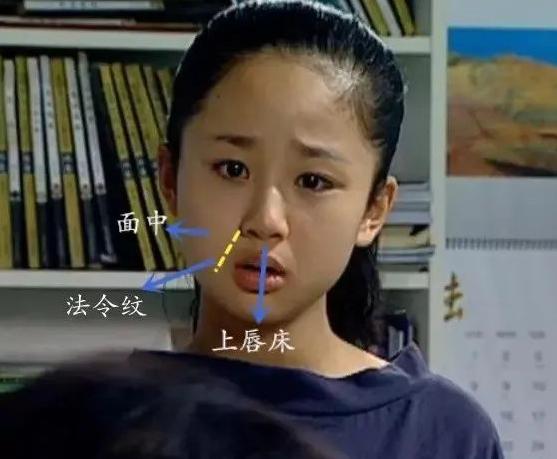 年纪不大为什么会有明显的法令纹,年纪轻轻为什么有很严重的法令纹