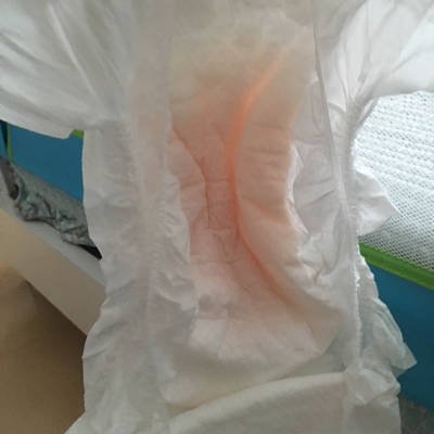 宝宝体重减轻了但不发烧,宝宝体重增加不明显