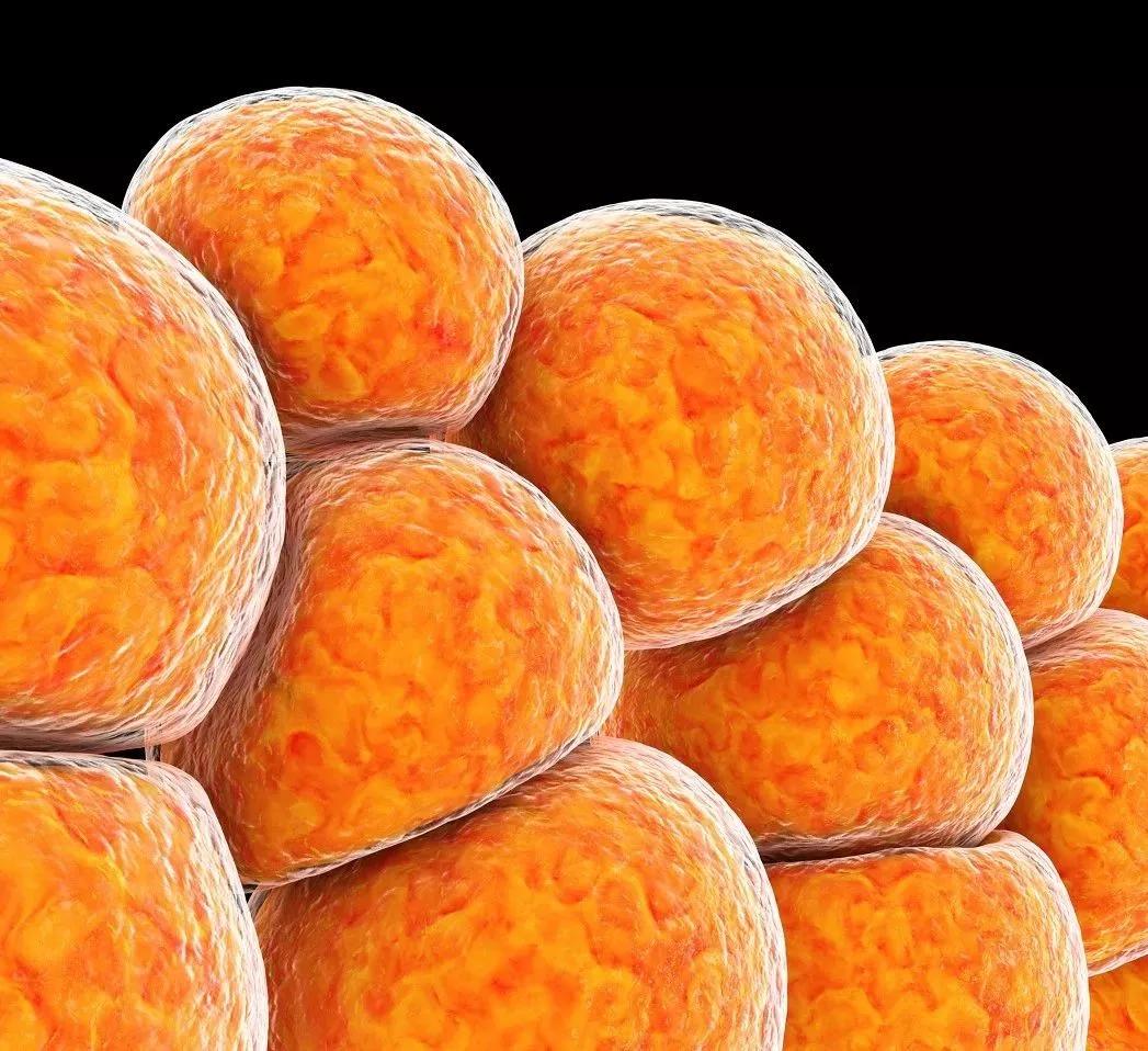 17个简单补救措施轻松摆脱眼袋,怎样预防和祛眼袋