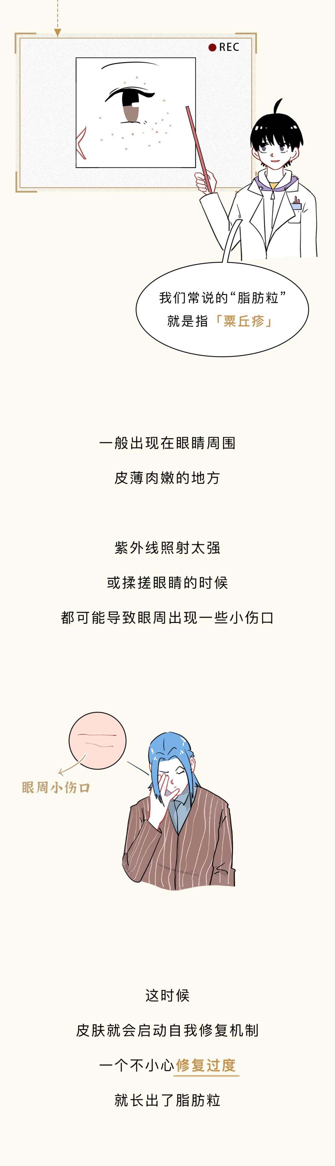 眼睛周围的脂肪粒到底是啥,小孩眼睛周围长很多脂肪粒