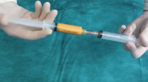 脂肪胶填充好还是svf填充好,脂肪填充用干细胞还是prp好