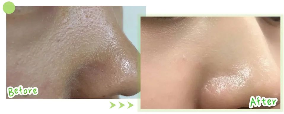 皮肤怎么变得白白嫩嫩干干净净,怎么让自己变得白白嫩嫩