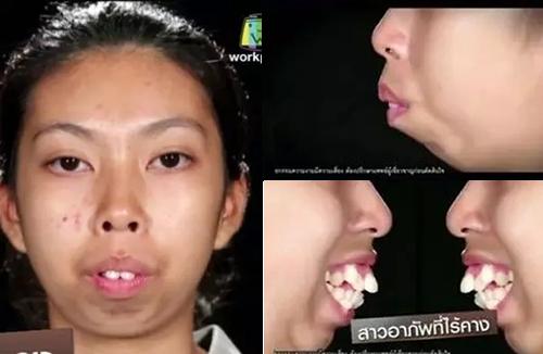 泰国最逆天的不是变性，而是堪比换头的整形