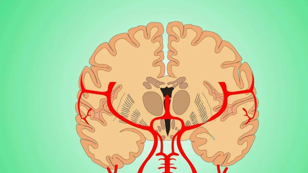 面对一个患有脑梗的怎么去安慰,中医耳道取栓治疗脑梗