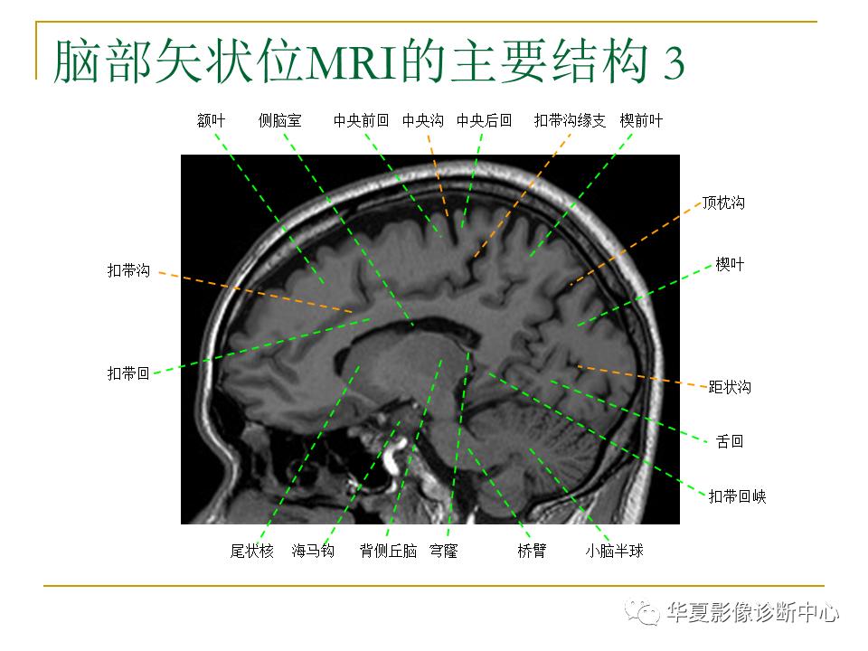 中国人脑立体定向mri应用解剖图谱,脑mri示意图