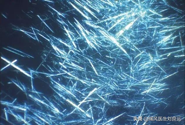 尿酸高痛风脚痛一般打什么针呢,尿酸高痛风脚痛一直不好怎么治