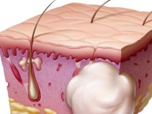 女性炎症私护的正确做法,女性内阴护理用什么药