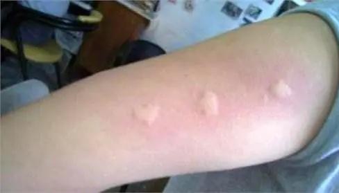 蚊子克星夏天外出必备,蚊子最怕的老窝