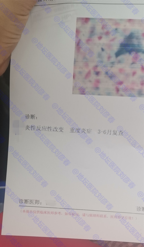 tct炎症反应性细胞改变需要治疗吗,宫颈tct显示重度炎症需要治疗吗