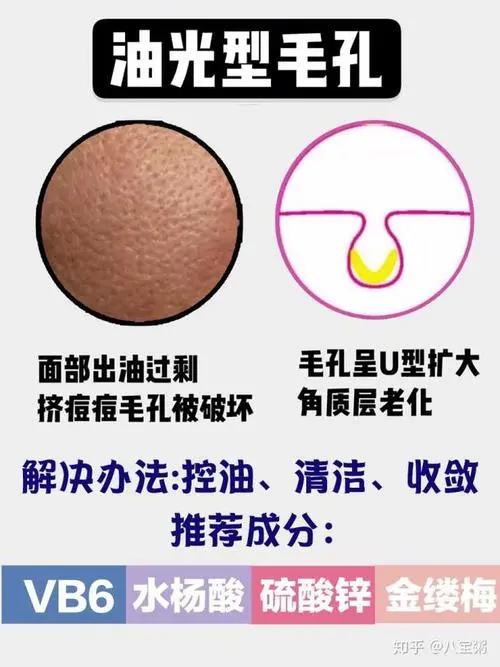 毛孔粗大公认解决方法,毛孔粗大最简单有效的方法