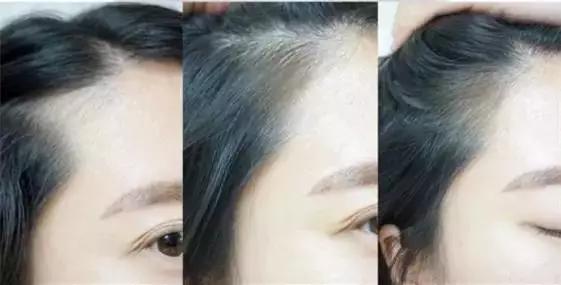 美国版睫毛增长液,法国进口的睫毛增长液真的有效吗