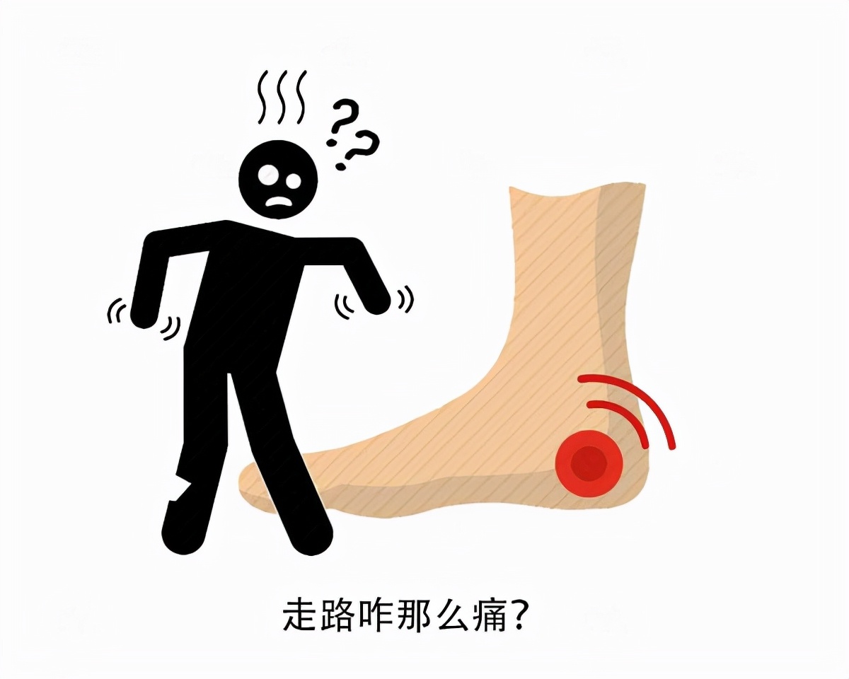 寒潮来临前全身关节都有反应,天气冷了关节痛是属于什么关节炎