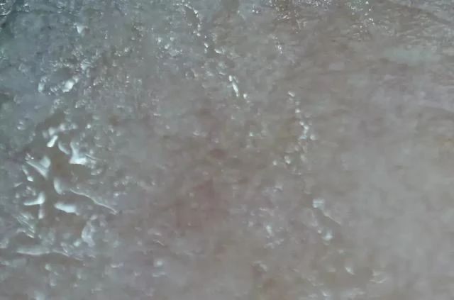 杨紫近照曝光无修图法令纹很深,杨紫面部填充法令纹