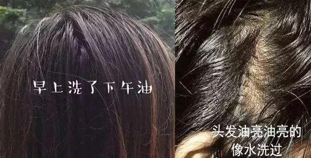 去头屑去螨虫哪个洗发水最有效,去头屑去螨虫用哪个洗发水最有效