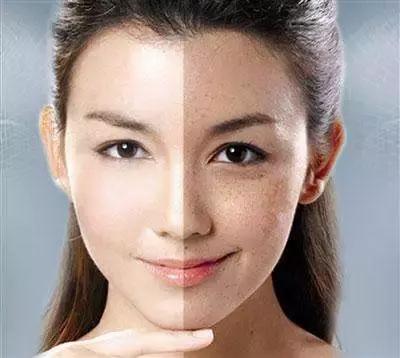 姜蜜水怎么去除老年斑,姜蜜水祛斑最快的方法