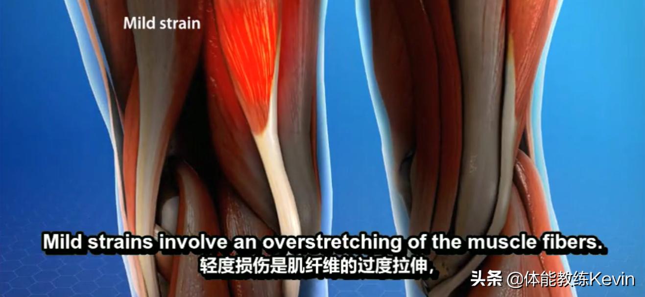 腘绳肌拉伤恢复训练方法,预防腘绳肌拉伤的方法