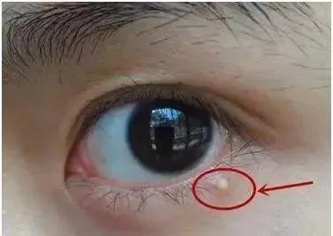 贵眼霜和便宜眼霜的区别,科颜氏牛油果眼霜贵吗