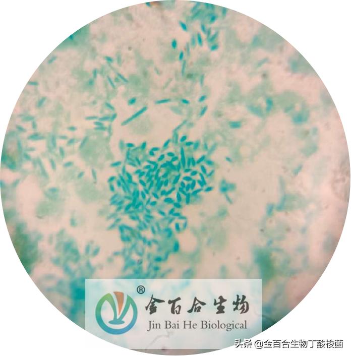 革兰氏染色显微镜下的图手绘,革兰染色用的显微镜是什么