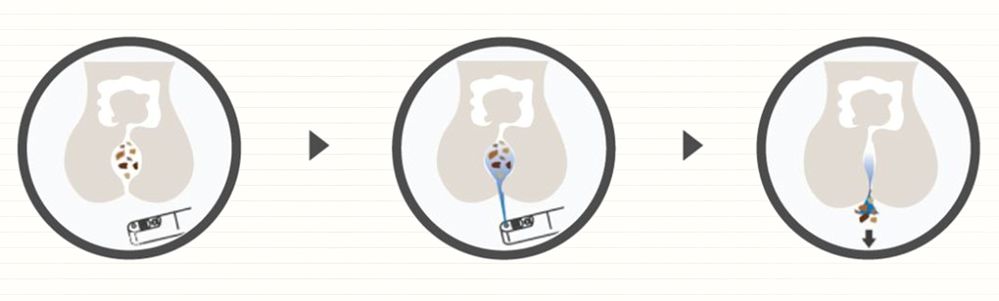 了解全自动坐便器智能马桶,智能马桶知多少