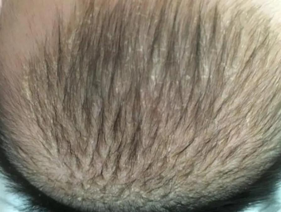 新生儿常见若干问题及解决办法|实用篇