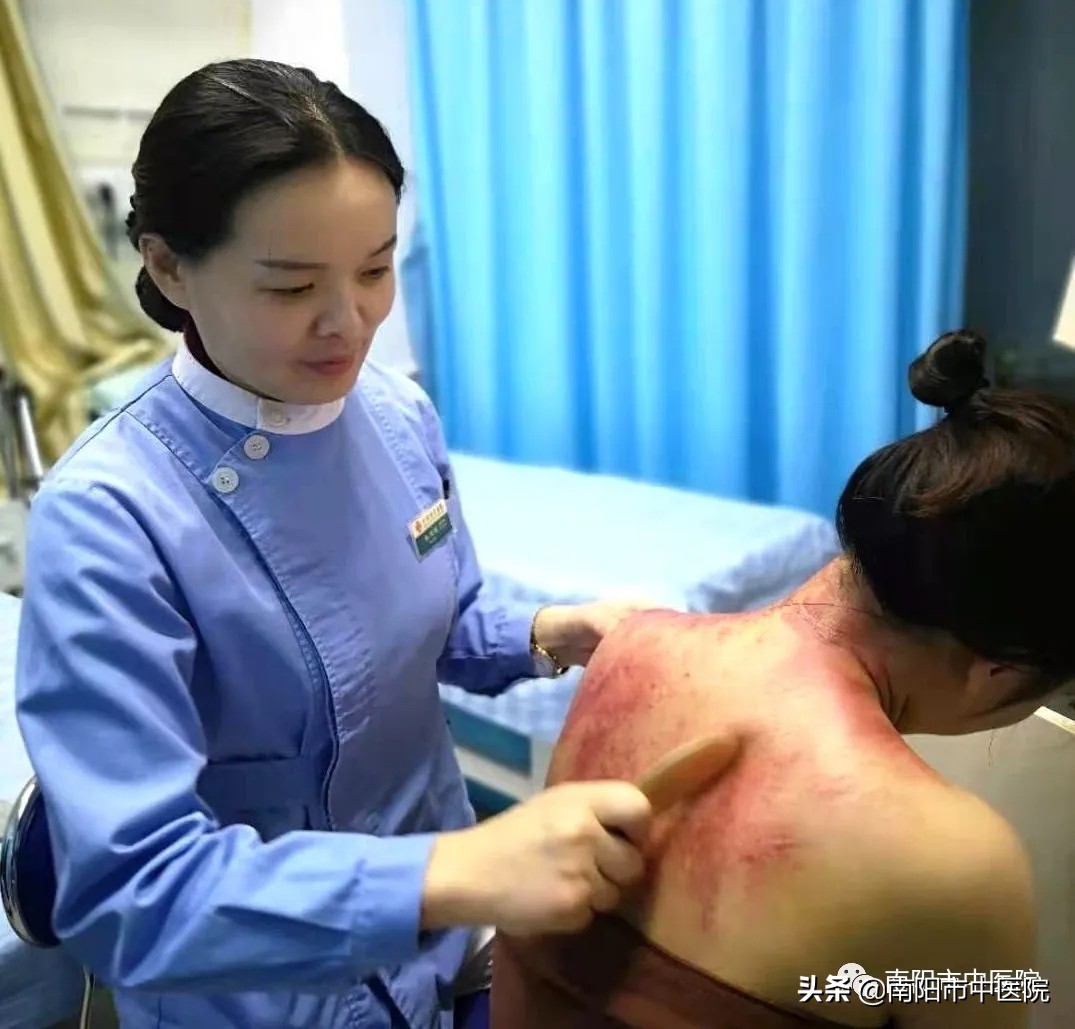 南阳市中医院开展多种中医特点治疗项目——虎符铜砭刮痧