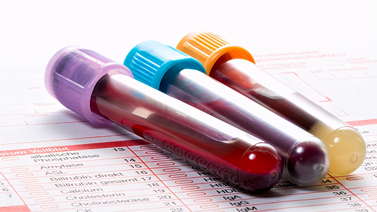 乙肝五项什么结果可以打乙肝疫苗,乙肝五项245阳性还要打疫苗