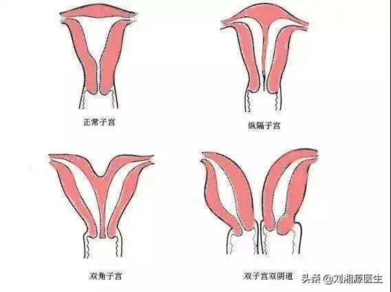 「免疫相关不良妊娠答疑解惑55」——复发性流产