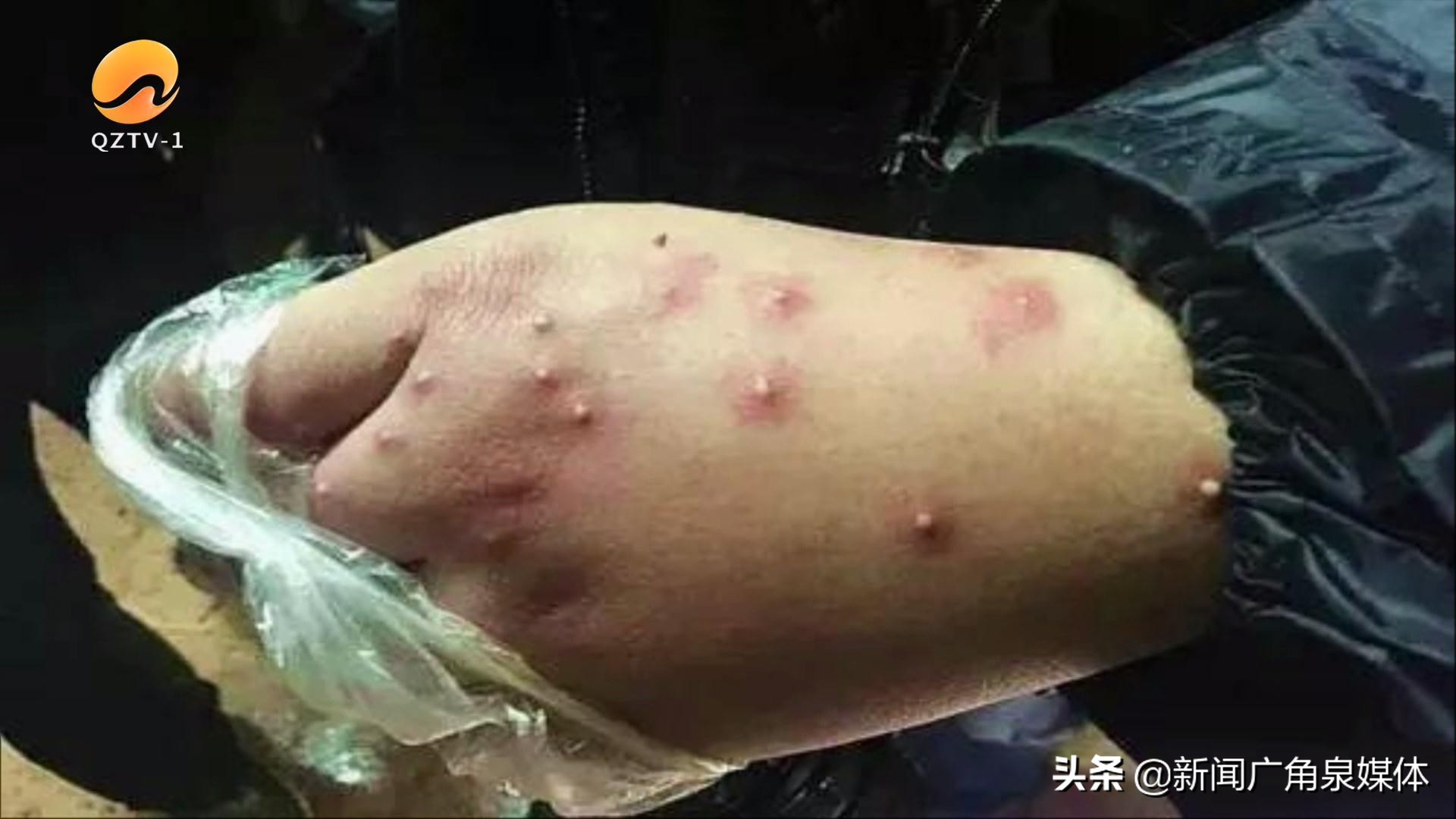 鍦ㄦ繁鍦宠鍏洯閲岀殑鏈煡铏瓙鍜簡,澶栨潵鐗╃鍏ヤ镜琚挰