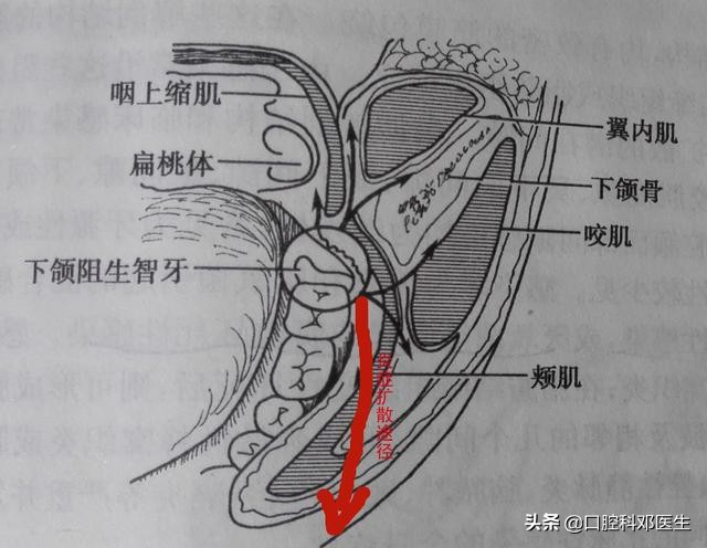 别让一颗牙齿毁了一张脸？医生说95%的人都有这样的牙齿！