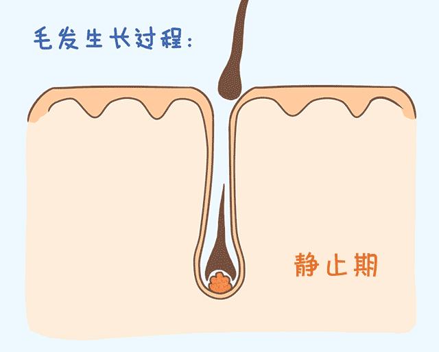 脱发知识普及,当代脱发现状