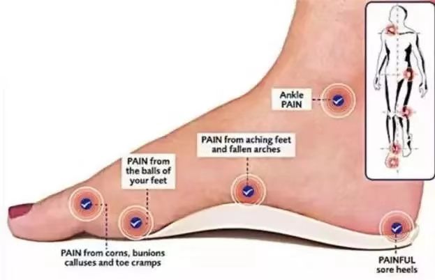 儿童扁平足的最佳治疗方法,全国治疗扁平足前十的医院