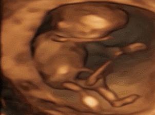 胎儿在妈妈肚子里干什么图片,胎儿在妈妈肚子里的位置变化