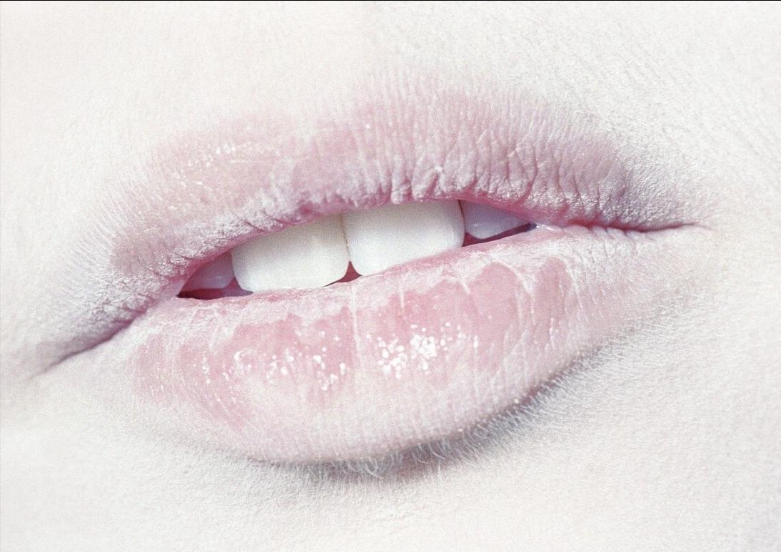 湿热该吃什么补脾胃,脾胃湿热怎么食物调理恢复最快