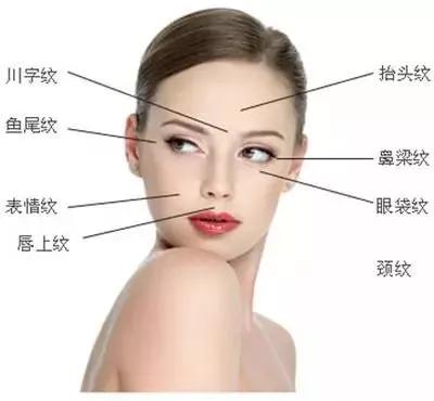 什么样的人适合做面部除皱术,关于面部除皱的常见问题有哪些