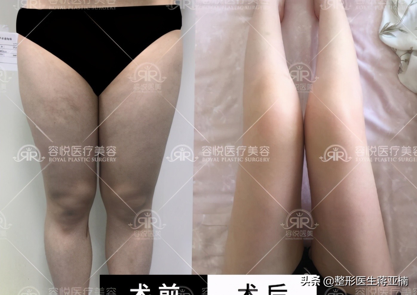 一次性说清,一次性说清要求