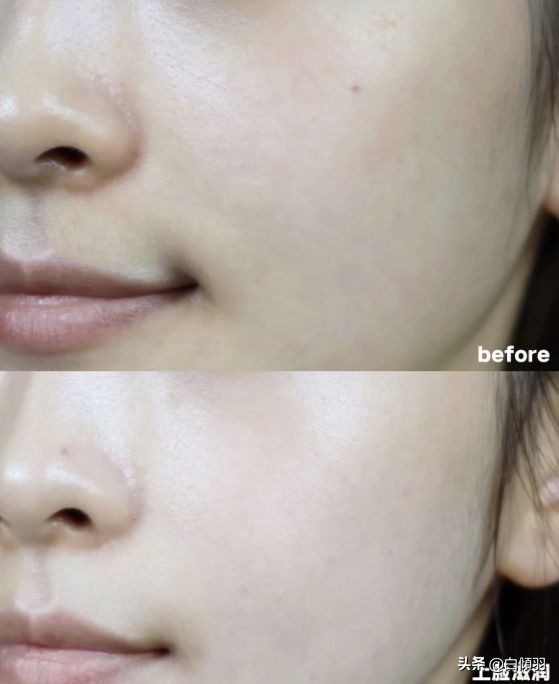 过度护肤导致角质层受损怎么修复,护肤品真能修护角质层吗