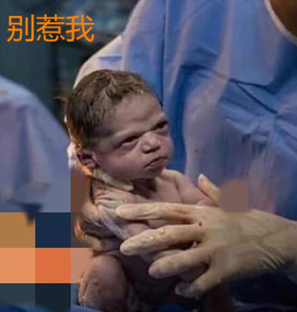 剖腹产宝宝出声表情严肃“眼神”霸气，火了：我就是不哭