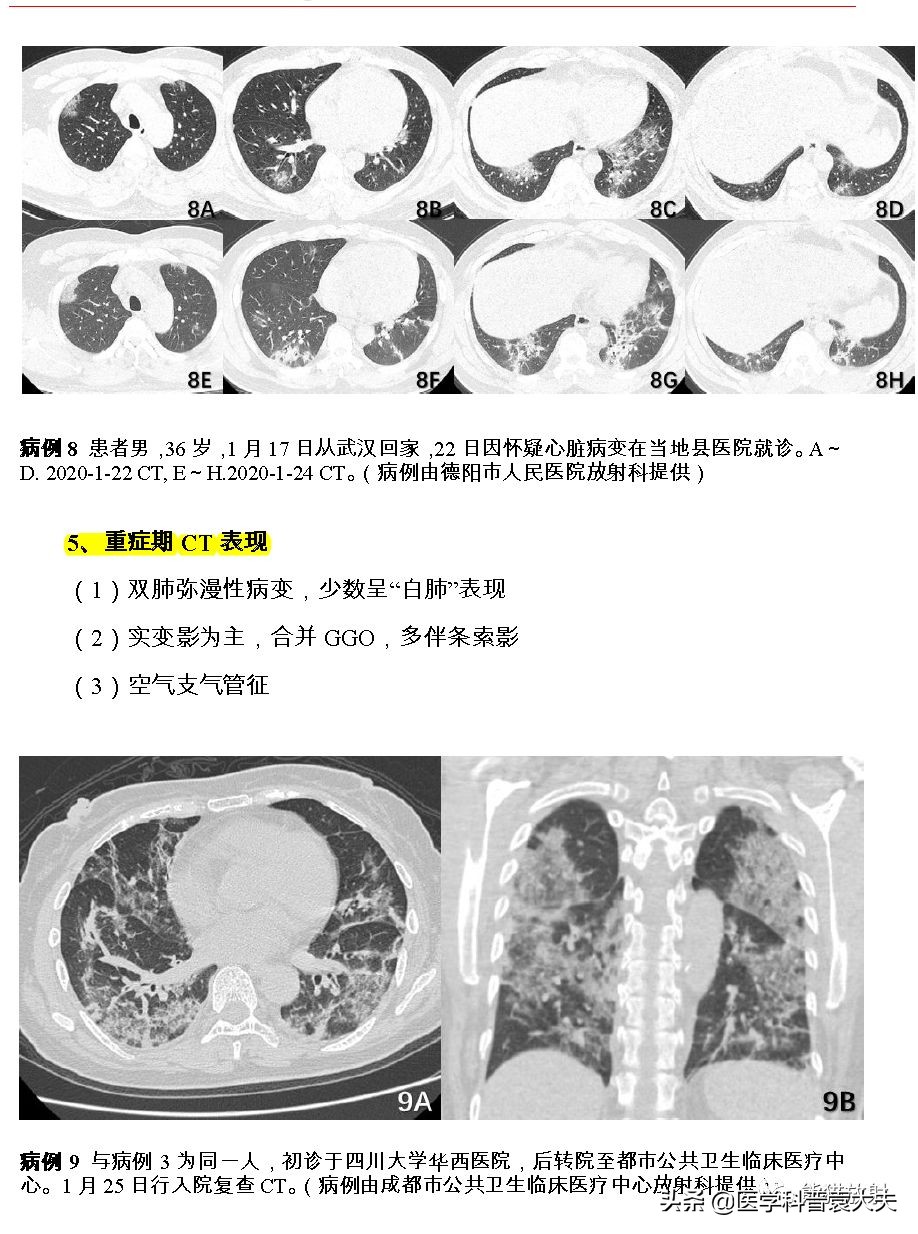 最新新型冠状病毒肺炎的指南,最新新型冠状病毒肺炎防控指南