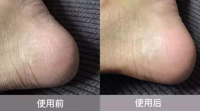 冉莹颖穿10小时高跟鞋，脱鞋后“触目惊心”，女人为了美真是拼了