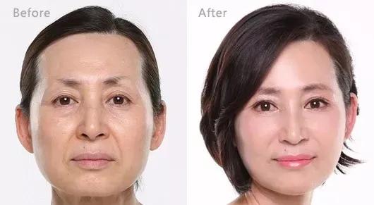 经常这样喝让你的脸色红润还养颜,每天坚持这样喝皮肤又白又嫩