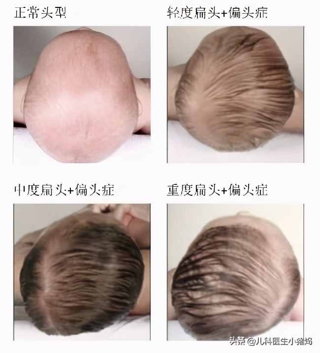 这4种习惯不注意孩子真的会变丑,基因决定孩子长相丑怎么办