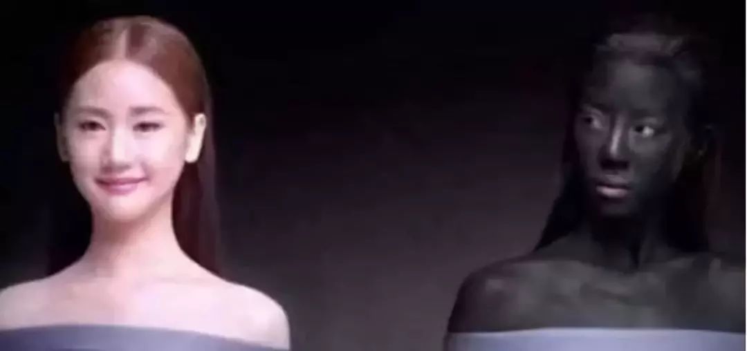 毛孔粗大怎么办最有效收缩毛孔,毛孔粗大用什么方法收缩毛孔