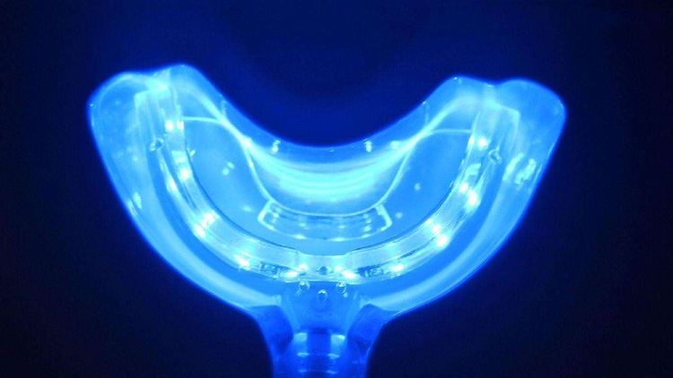 牙黄洗牙能让牙齿变白吗,牙黄不用白醋怎么解决