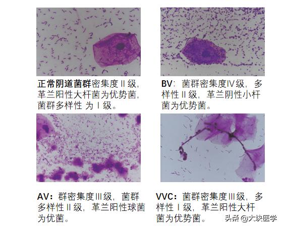 如何照顾特殊时期女人,特殊时期的女人被人体谅
