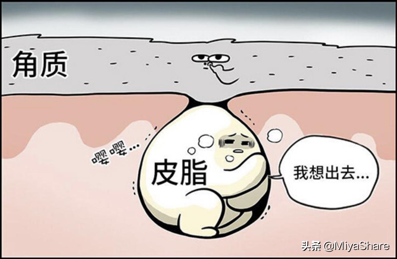 推荐祛痘产品大牌,学生党平价祛痘面膜推荐