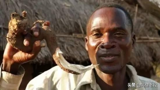 熨平少女胸部！揭秘非洲可怕习俗“烫乳”