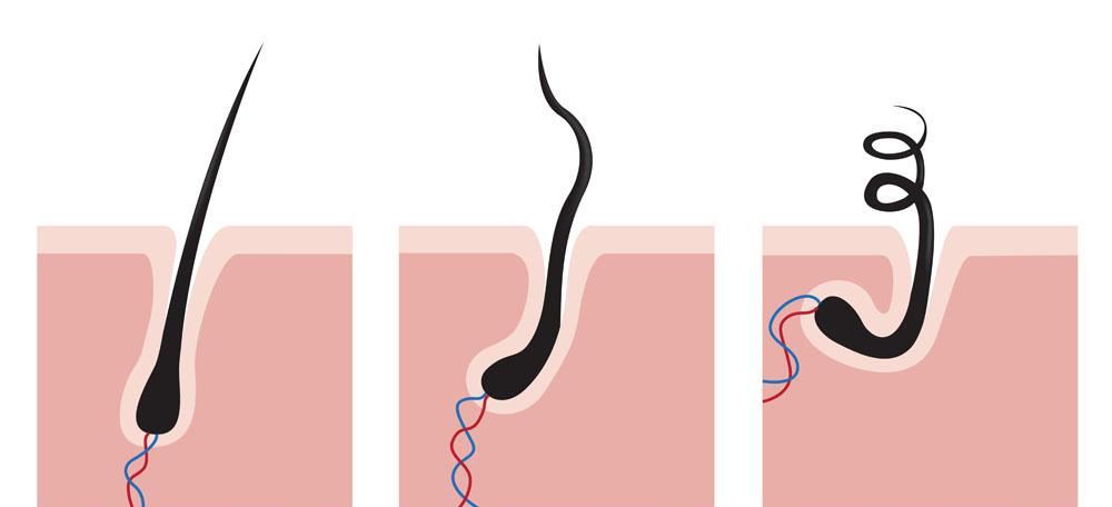 脂溢性脱发吃维生素b2可以痊愈吗,吃胱氨酸片和b6能治脂溢性脱发吗