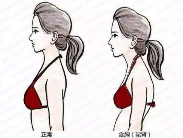 这四种孩子会越长越丑,什么样宝宝不担心越长越丑