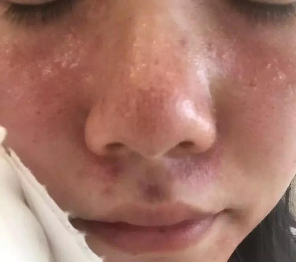 灏忕櫧涔熻兘闂溂鍏ョ殑鍖荤編椤圭洰,鍖荤編涓殑绱犻缇庤倢椤圭洰