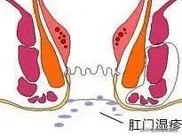 皮肤病是怎么引起的肛门瘙痒症,有哪些特效药可治肛门瘙痒症